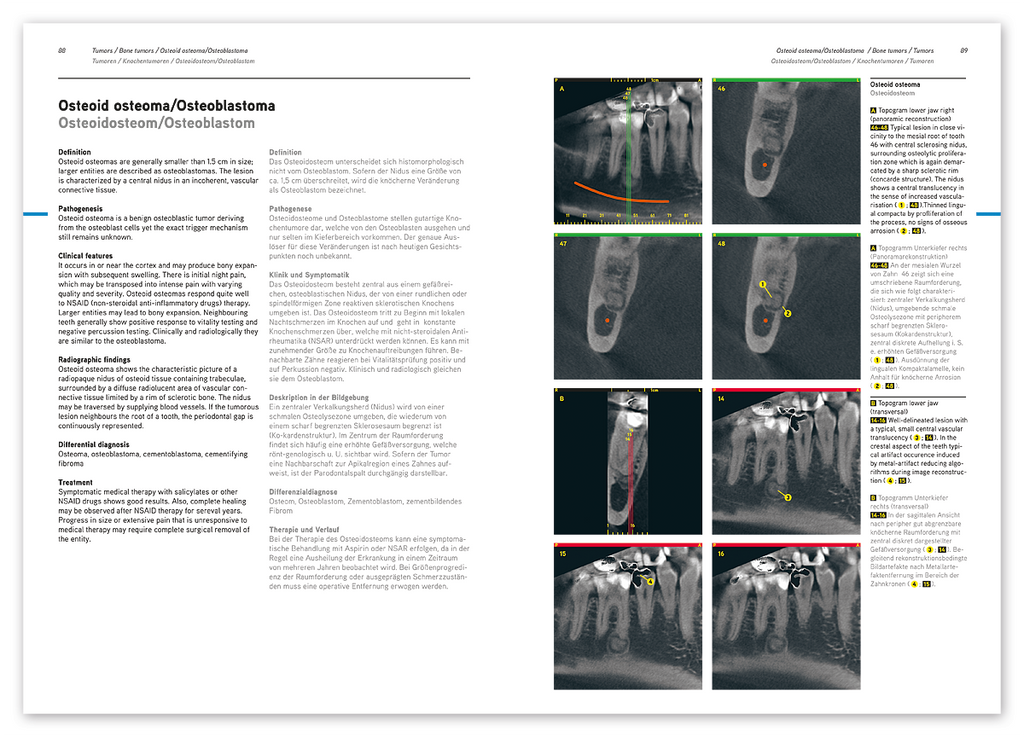 DVT-Diagnostik