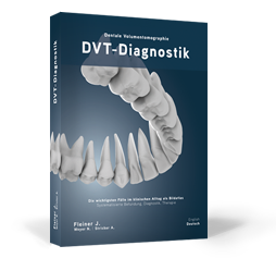 DVT-Diagnostik